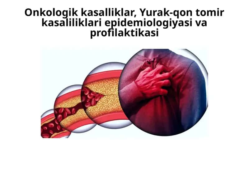 Onkologik kasalliklar: Epidemiologiya 1