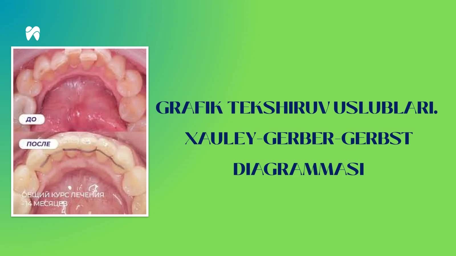 Xauley-Gerber-Gerbst Diagrammasi 1