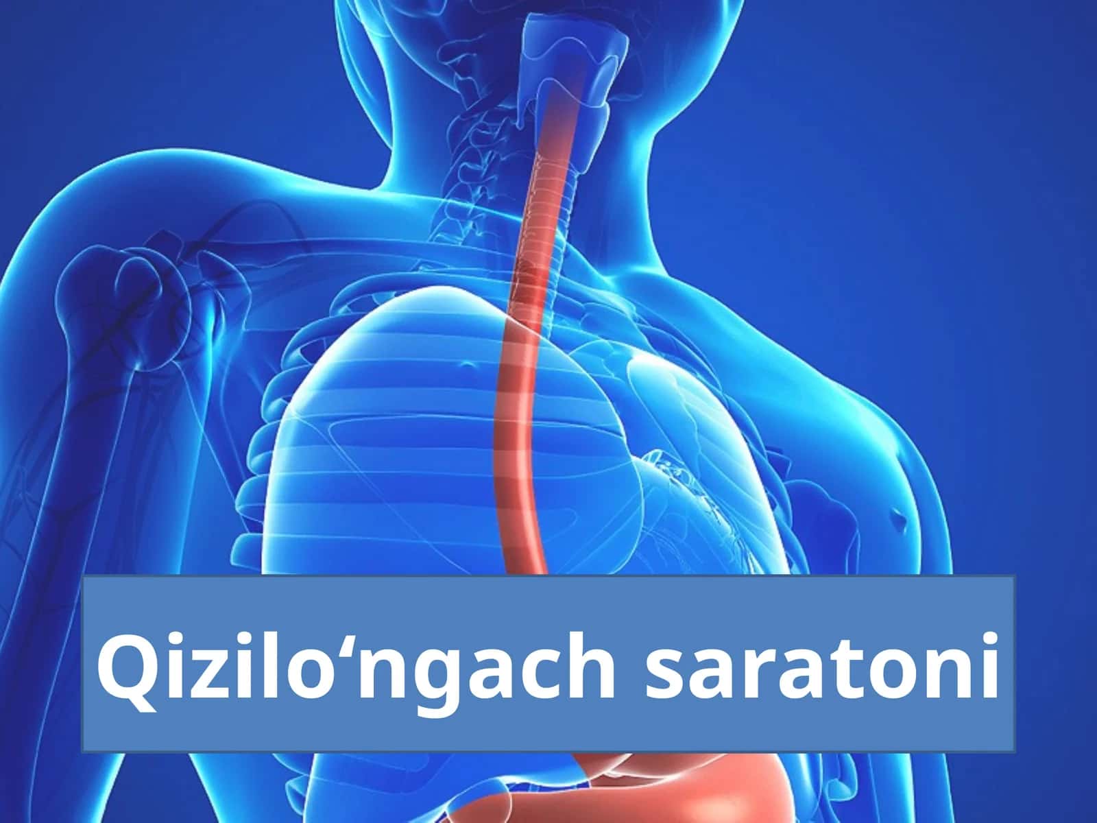 Qizilo‘ngach saratoni 1