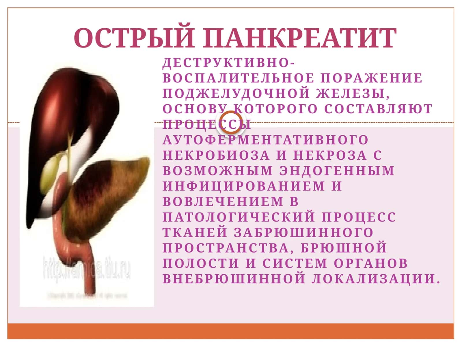 Острый панкреатит 1