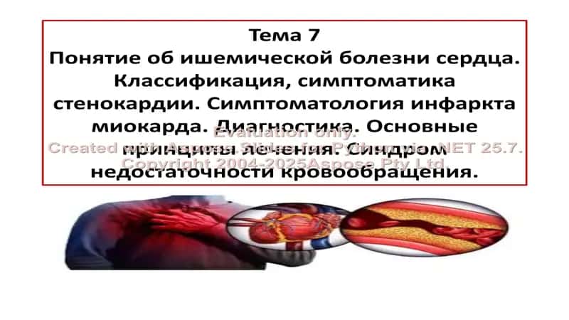 Ишемическая болезнь сердца 1