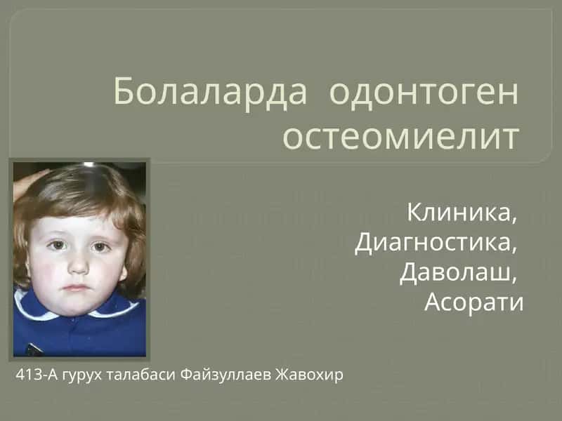 Болаларда одонтоген остеомиелит 1