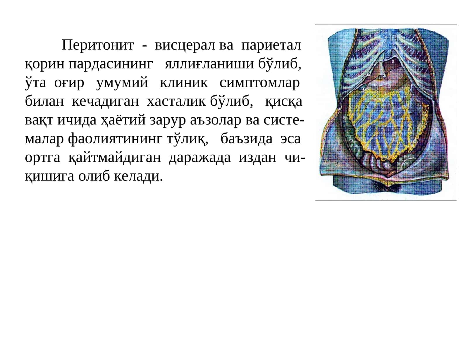 Перитонит-висцералвапариеталқор 1