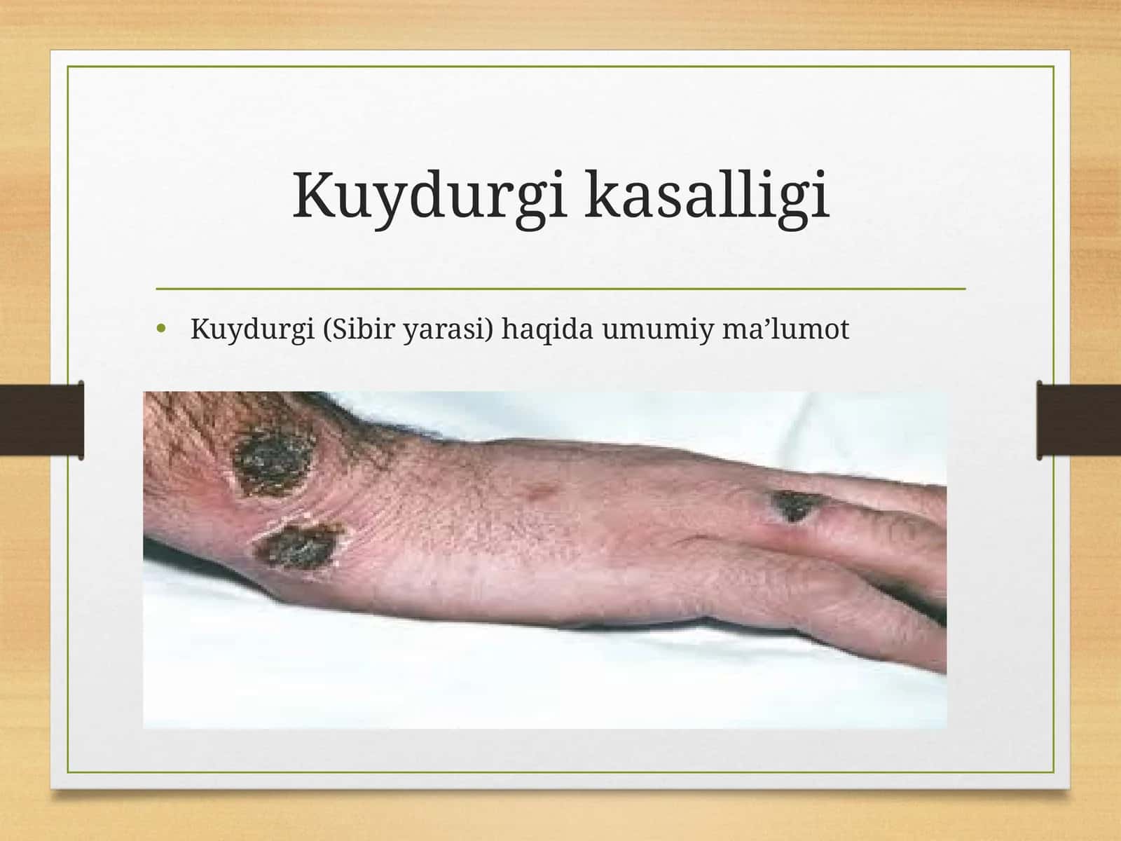 Kuydurgi kasalligi 1