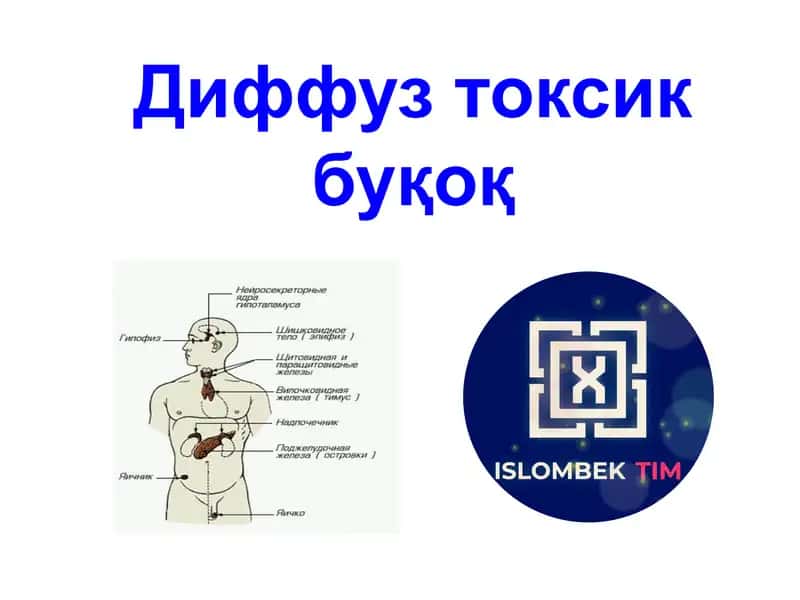 Диффуз токсик буқоқ 1