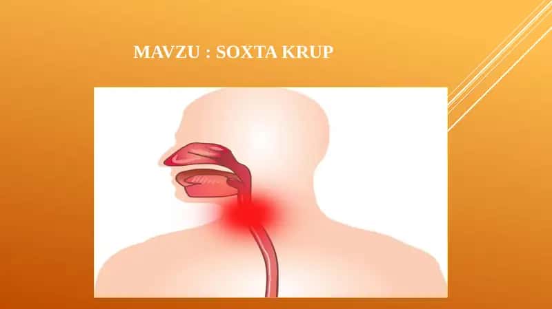 Soxta   krup 1