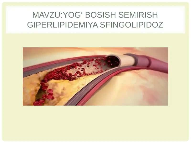Sfingolipidozlar 1