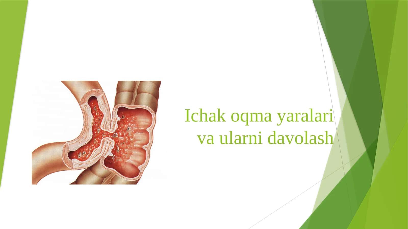 Ichak oqma yaralari va ularni davolash 1