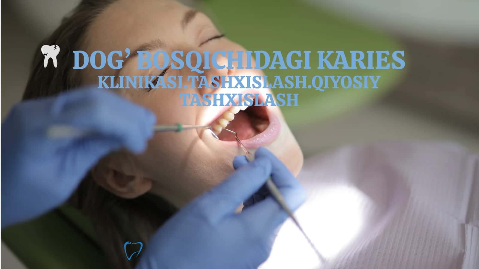 DOG’ BOSQICHIDAGI KARIES 1