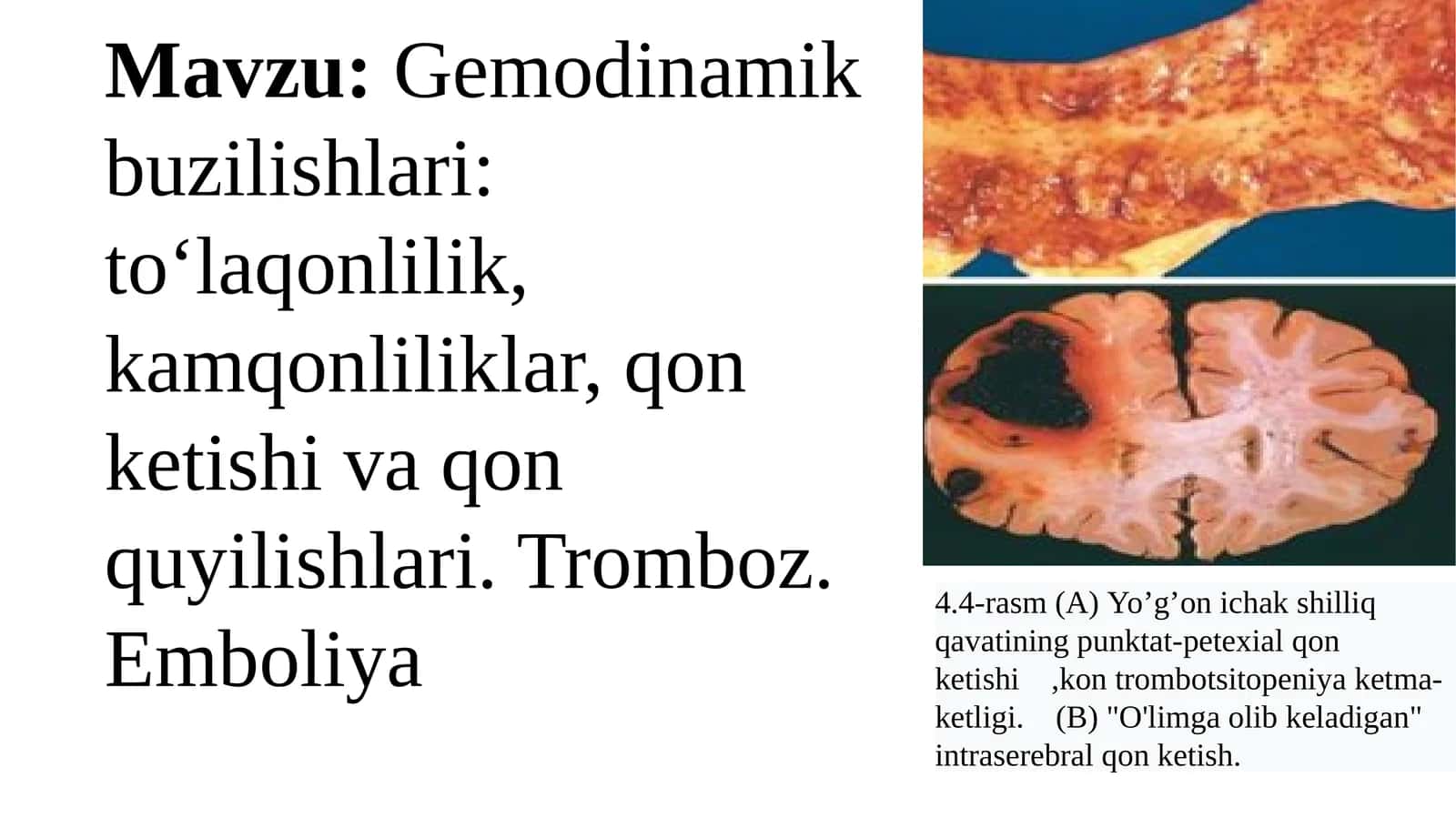 Gemodinamikbuzilishlari 1