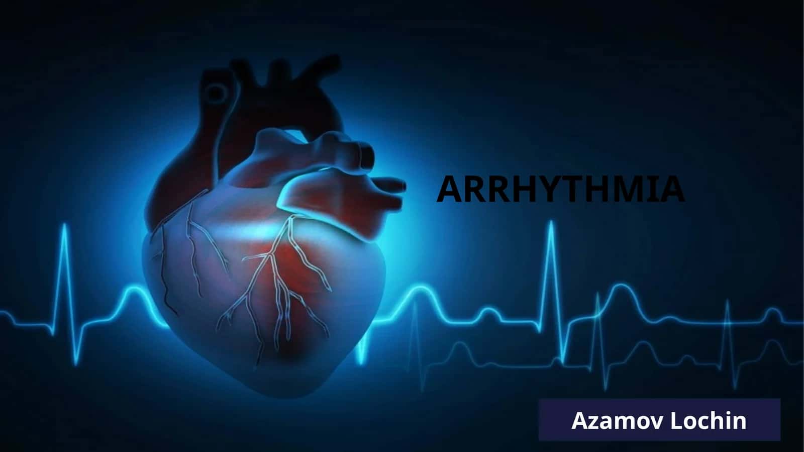 Supraventricular arrhythmia 1