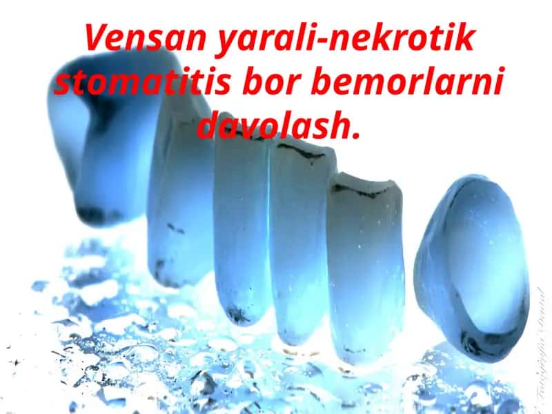 Vinsent Stomatiti 1