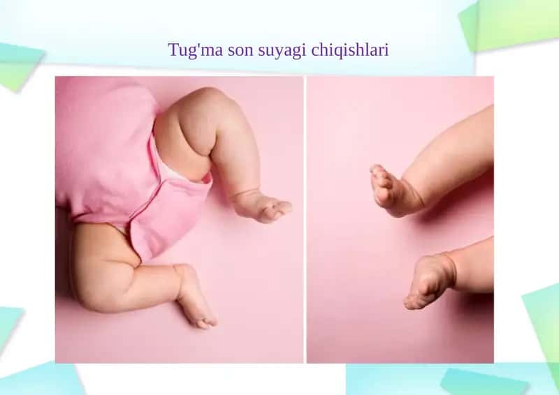 Tug'ma son suyagi chiqishlari 1