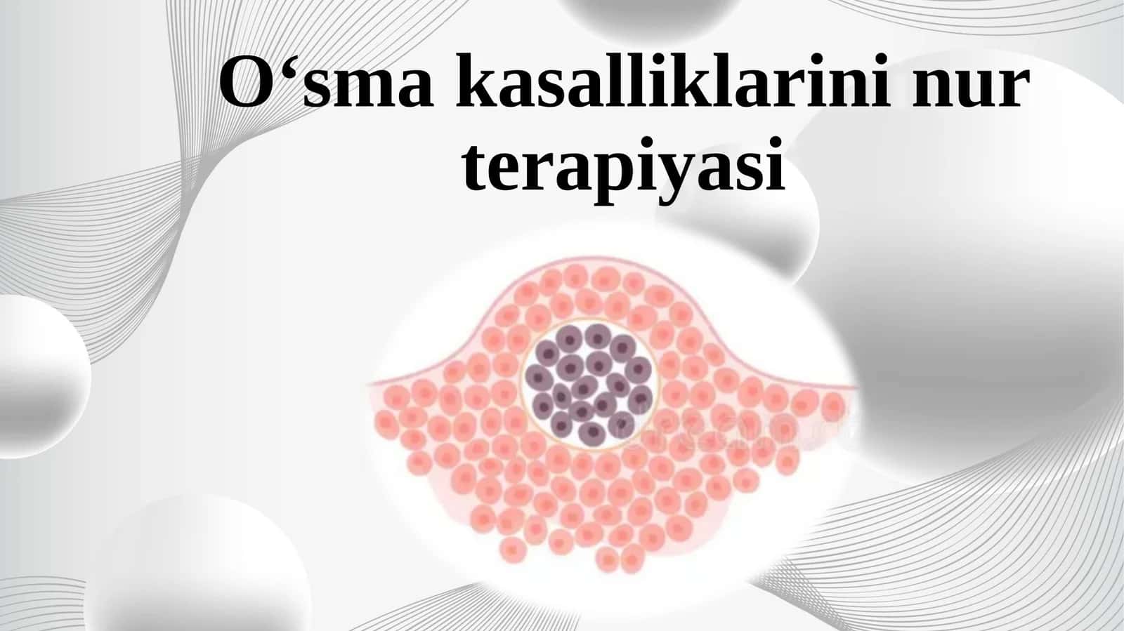 O‘smа kasalliklarini nur terapiyasi 1