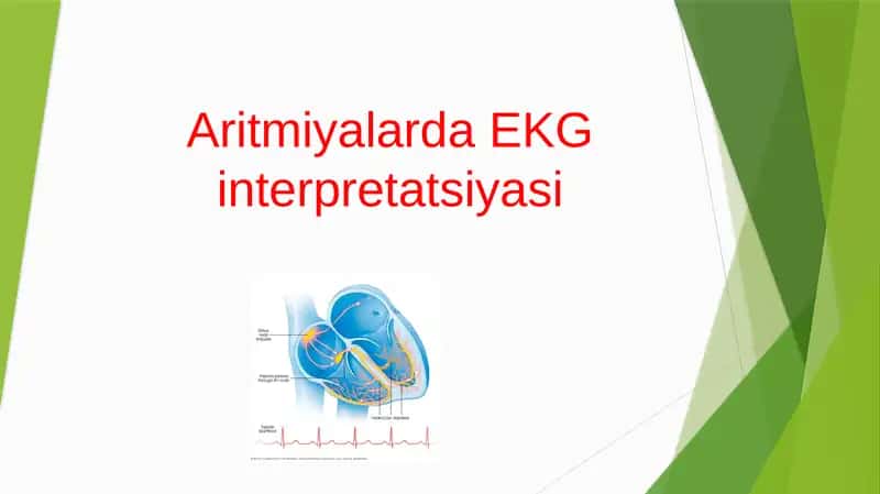 Aritmiyalarda EKG interpretatsiyasi 1