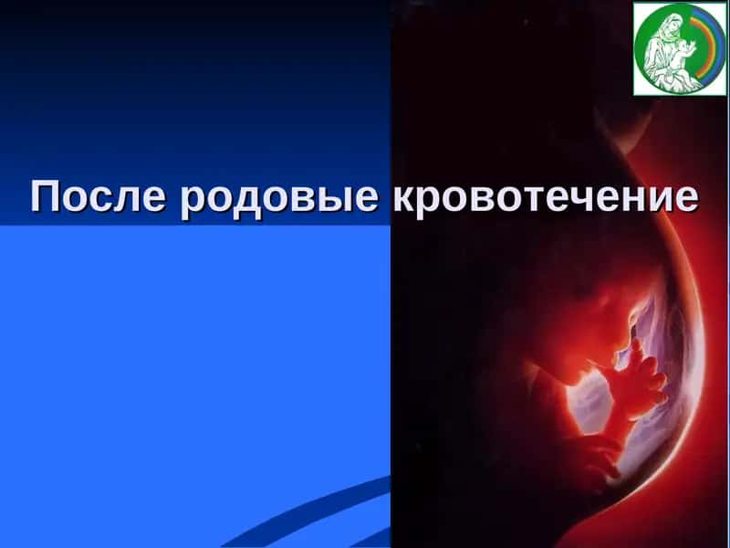 После родовые кровотечение 1