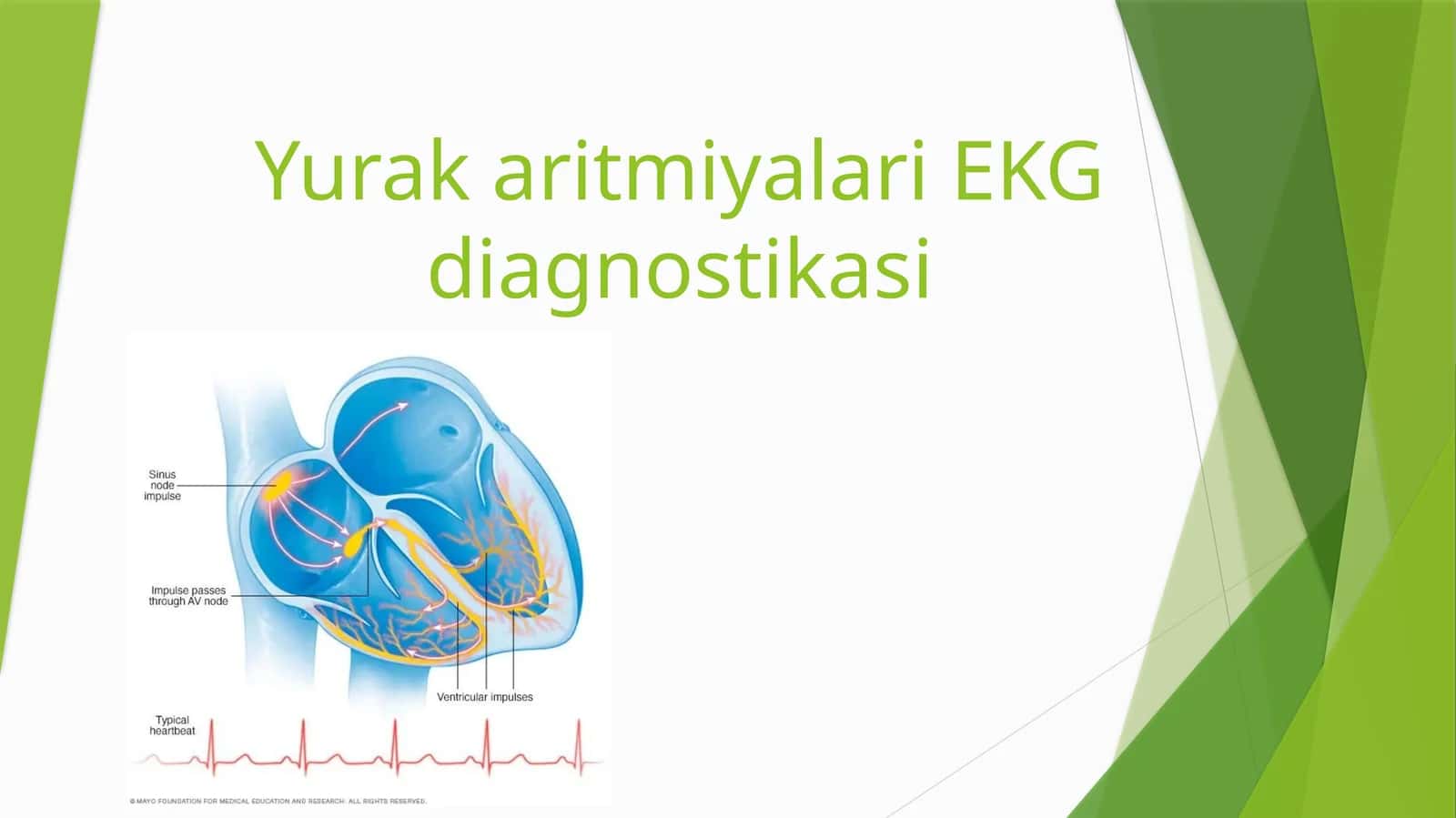 YurakaritmiyalariEKG diagnostikasi 1