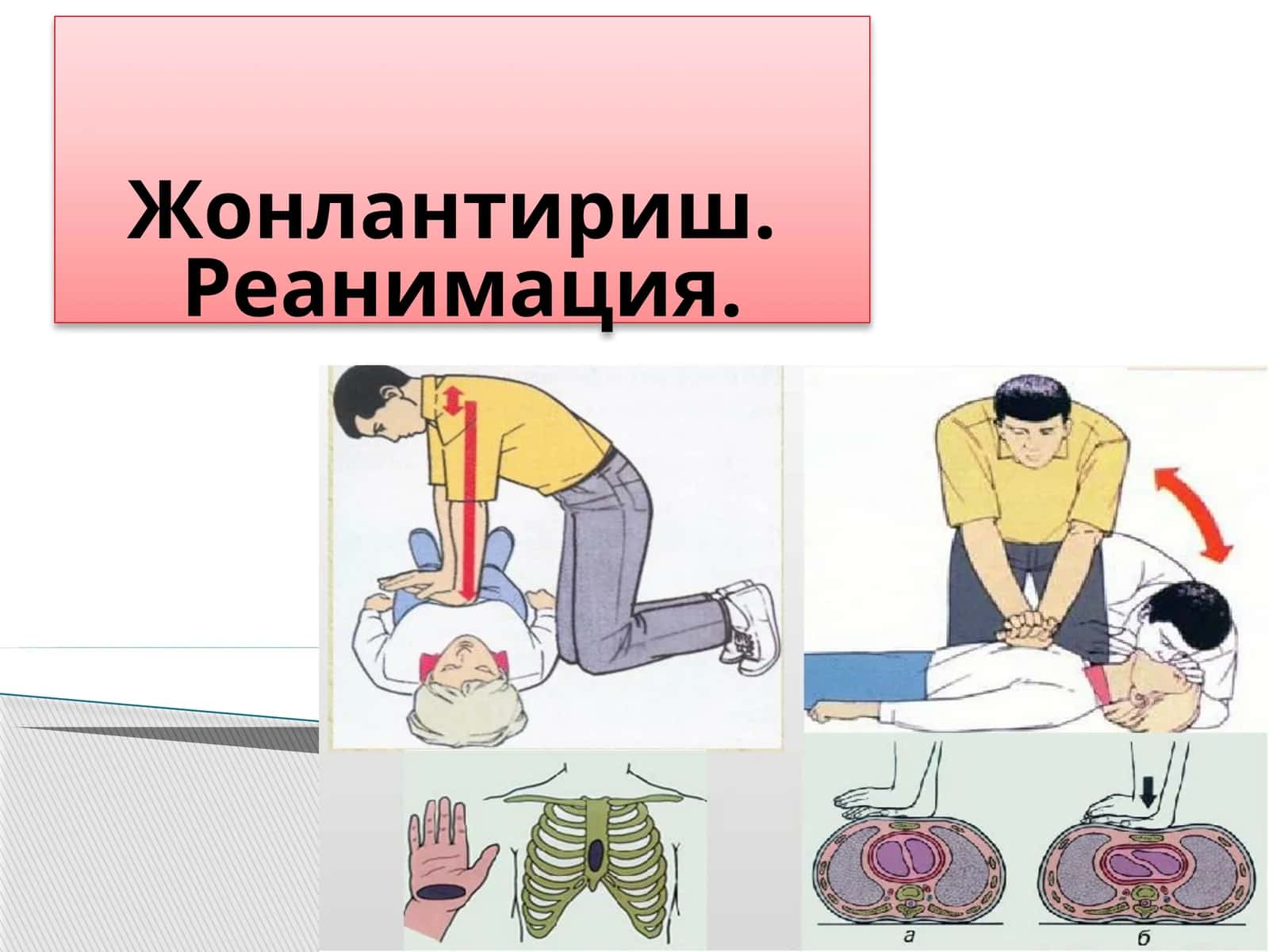 Жонлантириш. Реанимация 1