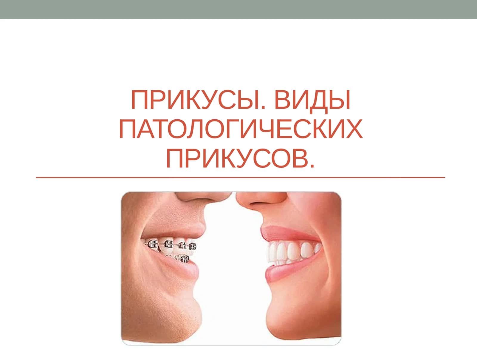 Прикусы. Виды патологических прикусов 1