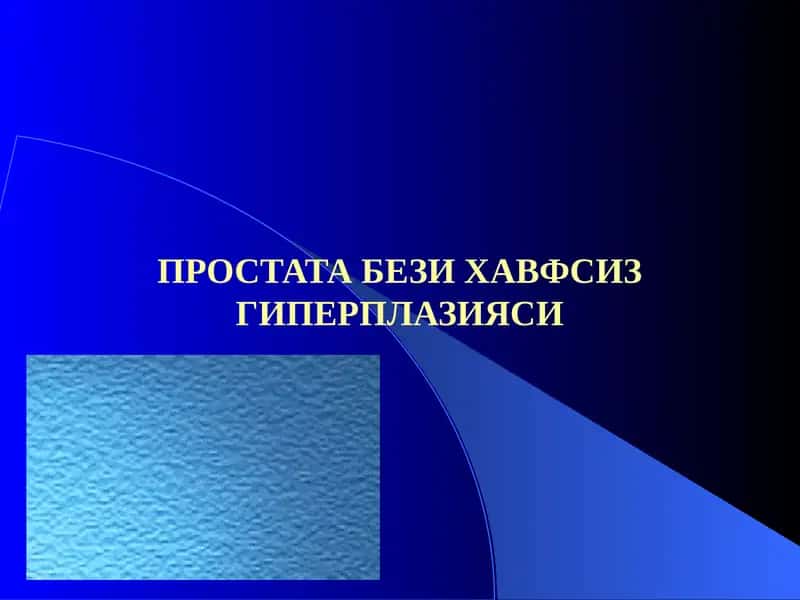 Простата бези хавфсиз гиперплазияси 1