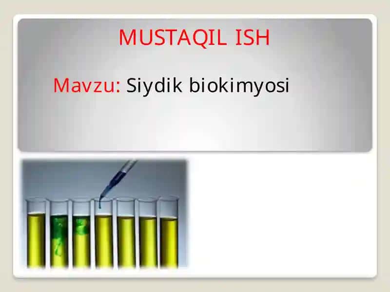 Siydik biokimyosi