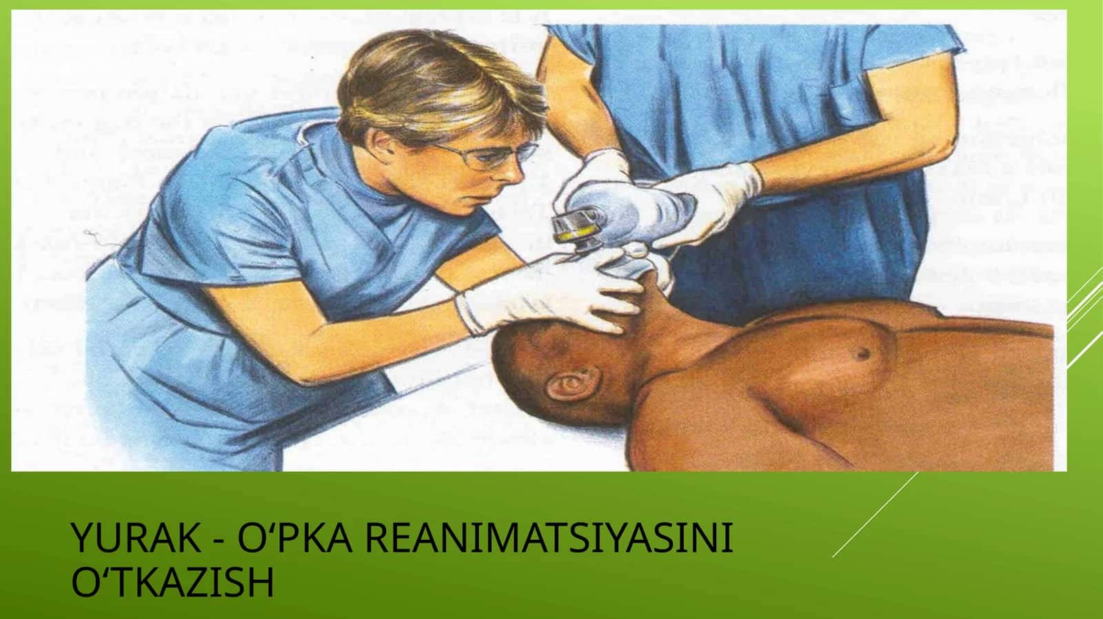 O'pka yurak ranimatsiyasini o'tkazish 1