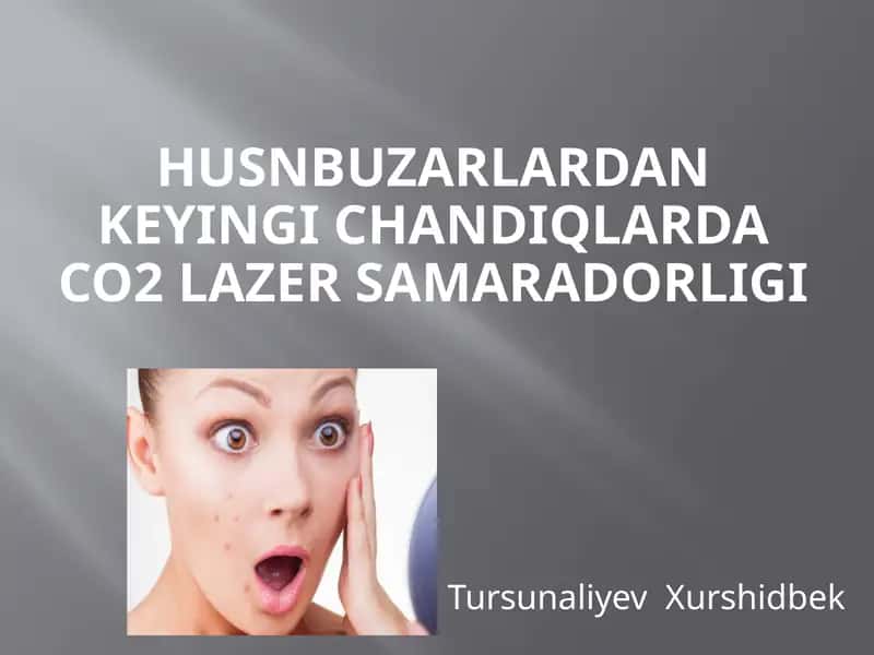 Husnbuzarlar 1