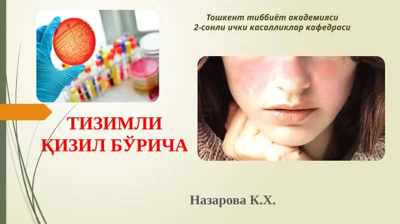 Тизимли Қизил Бўрича 1