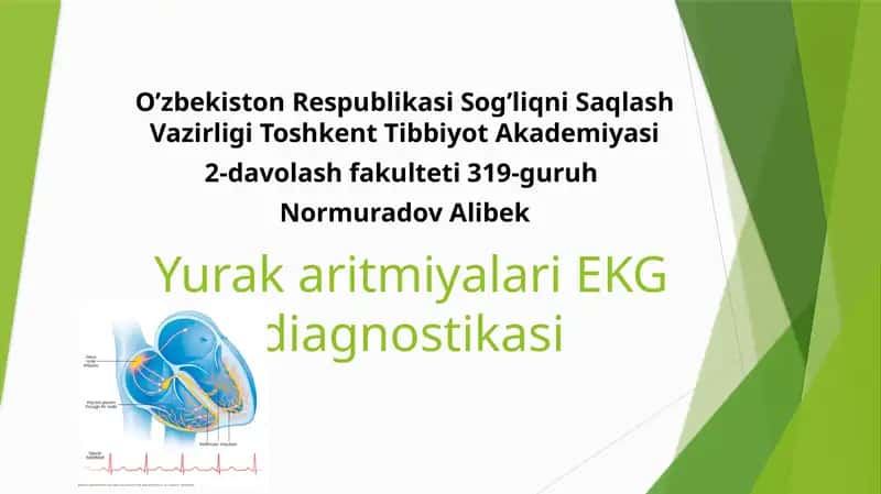 YurakaritmiyalariEKG diagnostikasi 1