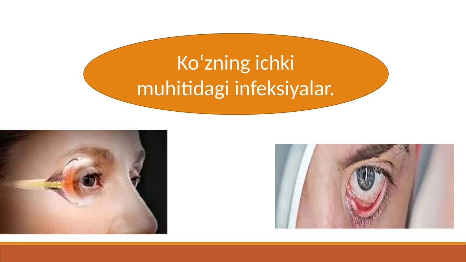 Ko‘zning ichki muhitidagi infeksiyalar. 1
