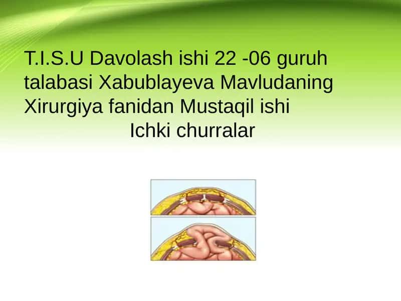 Ichki churralar 1