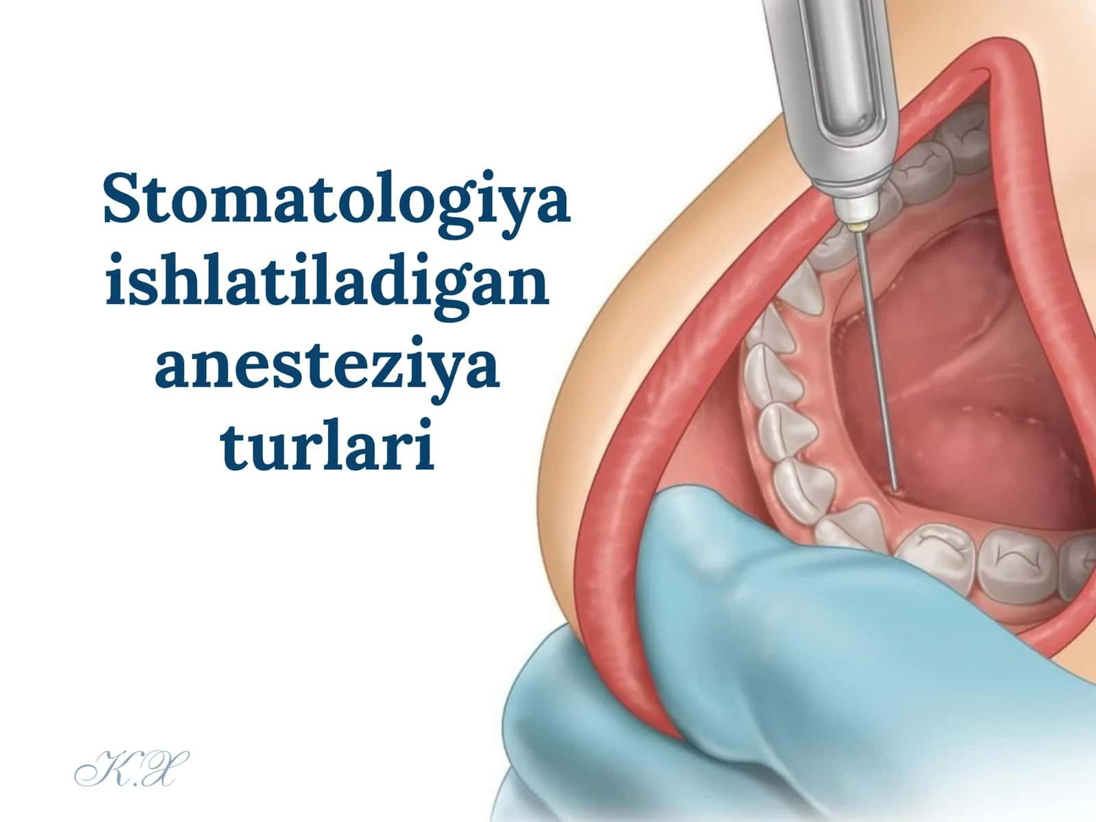 Stomatologiyada ishlatiladigan anesteziya turlari 1