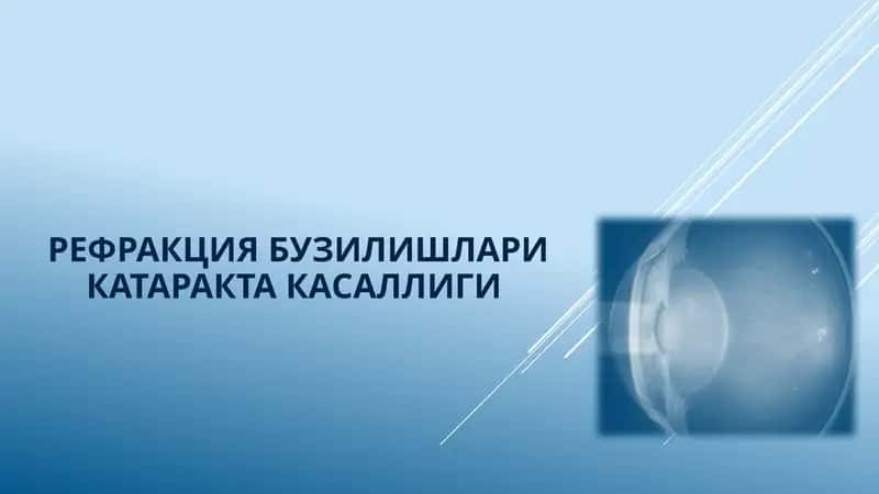 Рефракция бузилишлари катаракта касаллиги 1