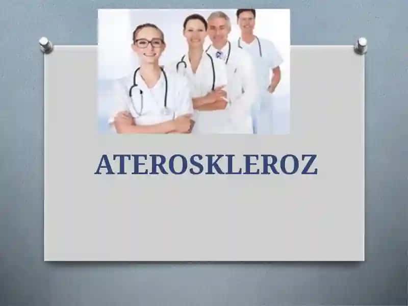 ATEROSKLEROZ