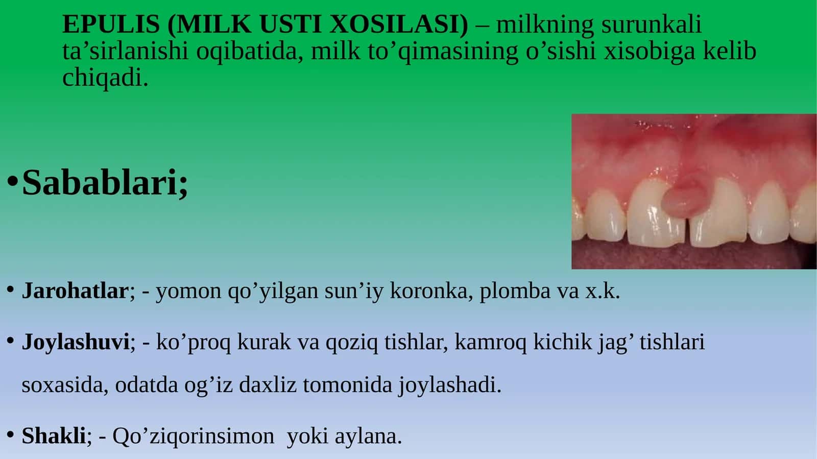EPULIS (MILK USTI XOSILASI) 1