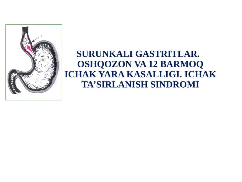 SURUNKALI GASTRITLAR 1