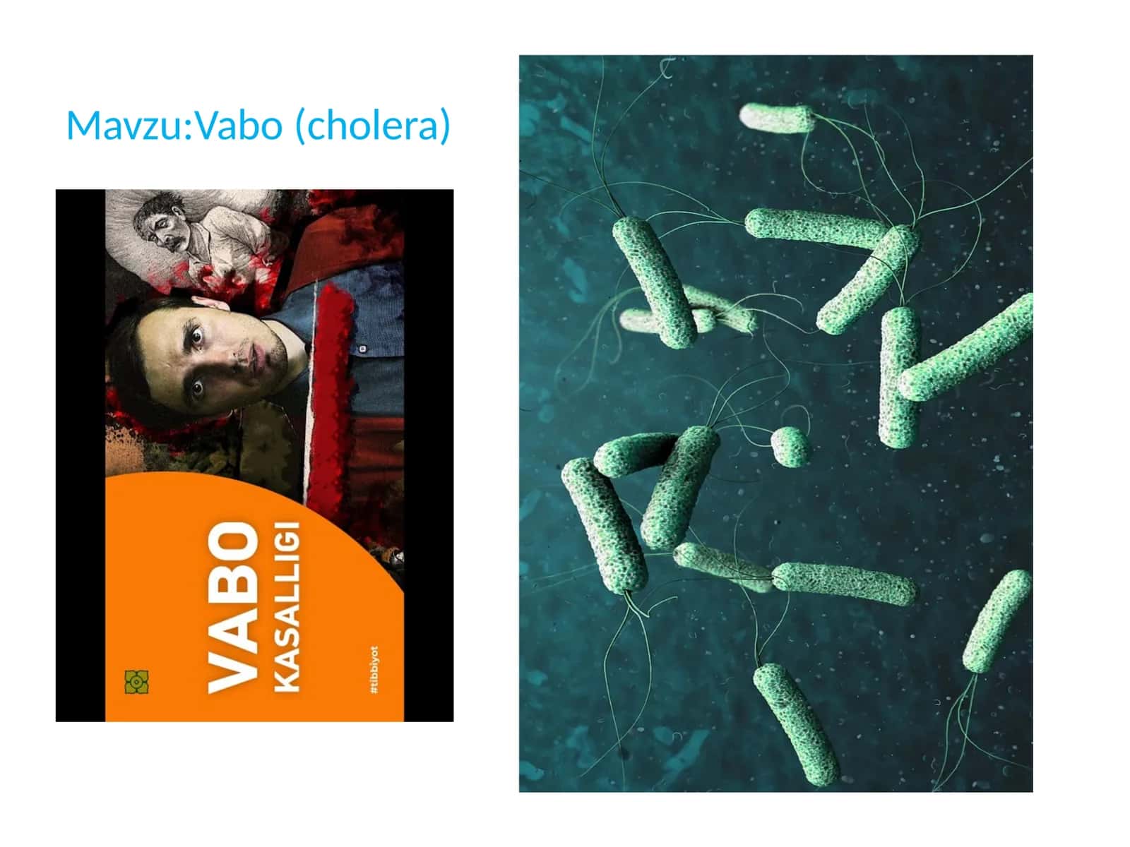 Vabo (cholera) 1