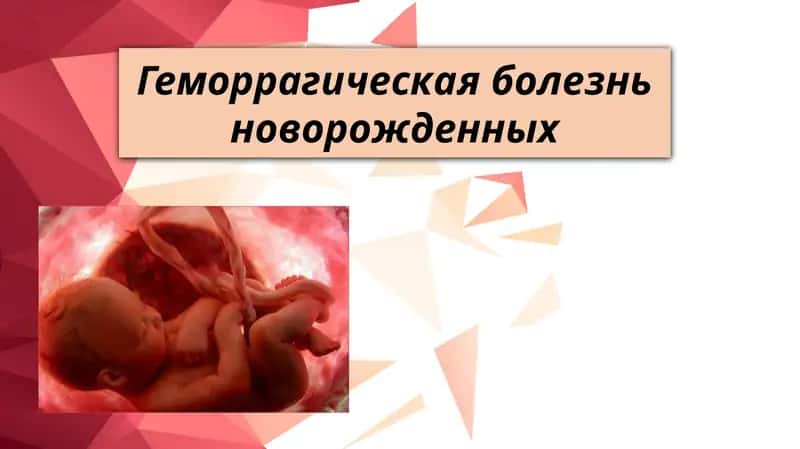 Геморрагическая болезнь новорожденных 1