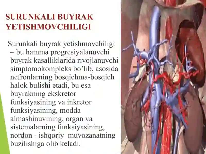 SURUNKALI BUYRAKYETISHMOVCHILIGI 2