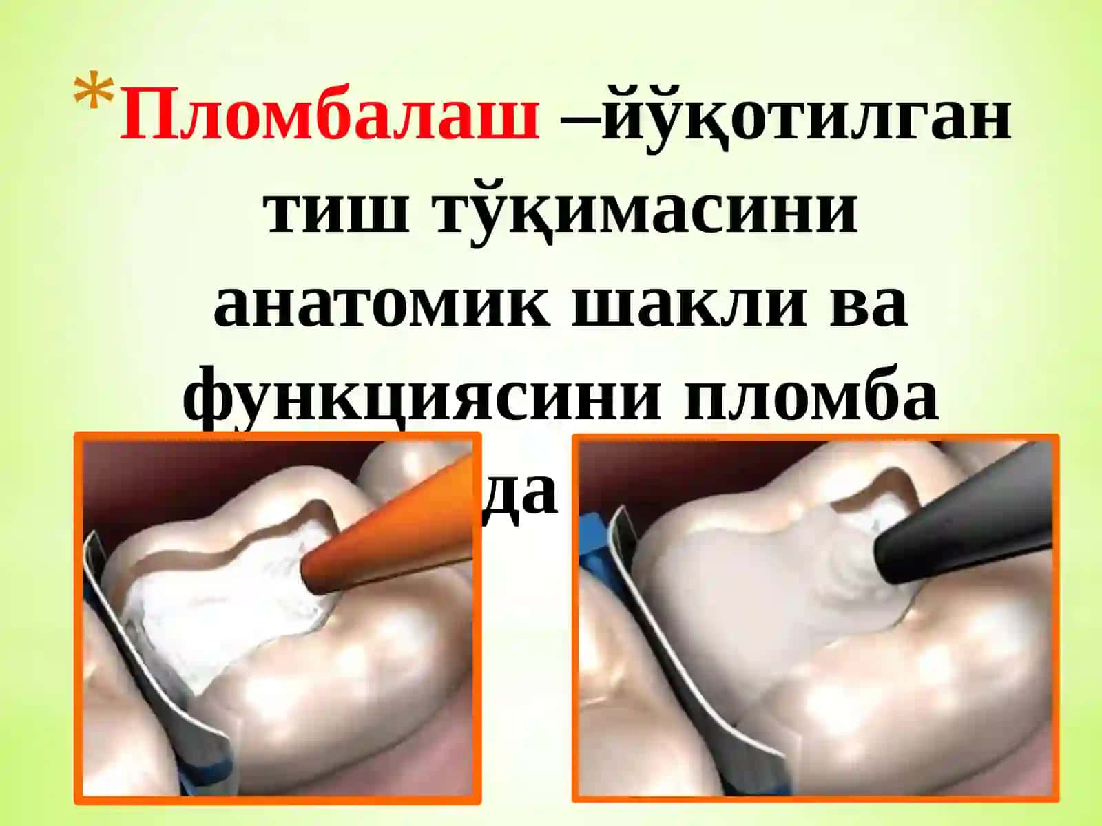 Пломба ашёларининг таснифи 2