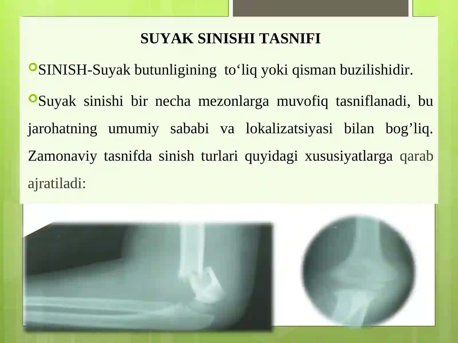 SUYAK SINISHI TASNIFI 2