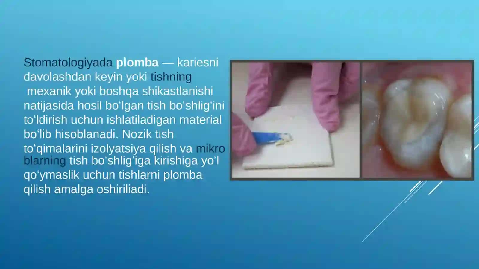 Kanalniplombalashdaqo`llaniluvchiplombaashyolari 2
