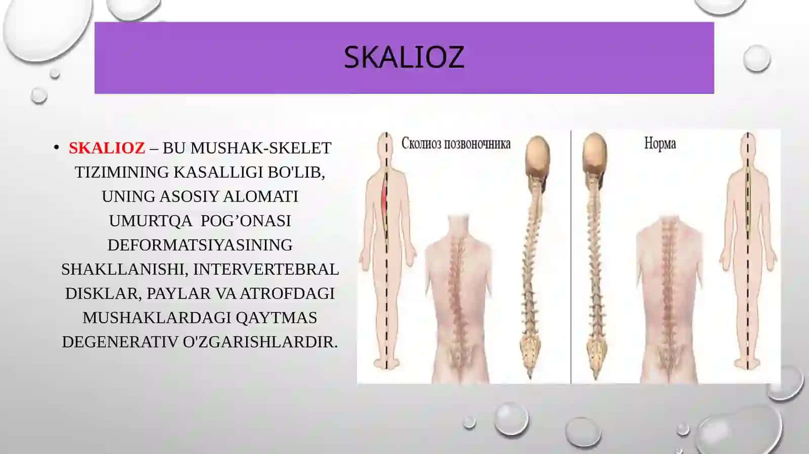 Skalioz 2