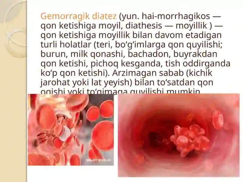 Gemorragik diatezlarning ko’rinishlari 2