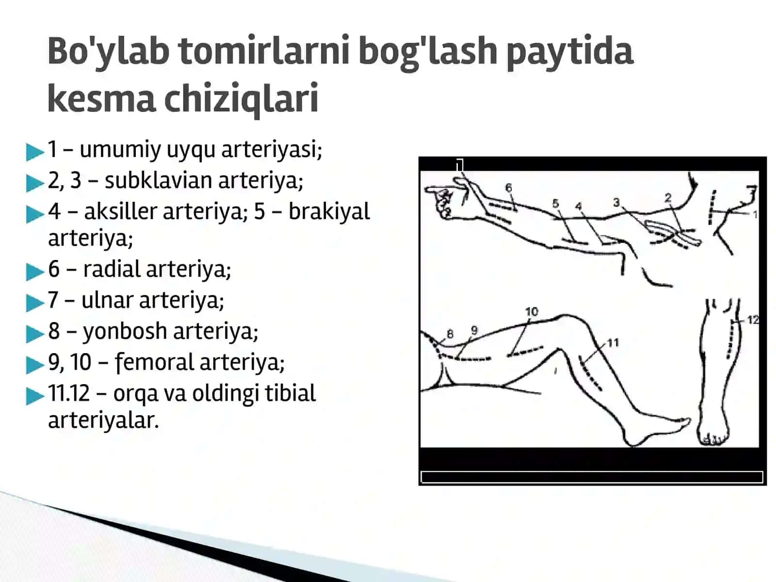 Qon tomir va rentgen endovaskulyar jarrohlik 2