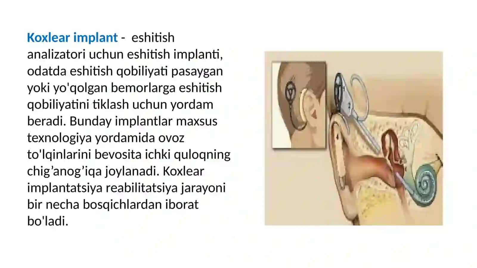 Koxlear implantatsiyasi operatsiyasidan oldingi va keyingi reabilitatsiya mazmuni 2