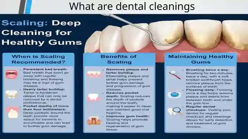 Dental Cleanings 2