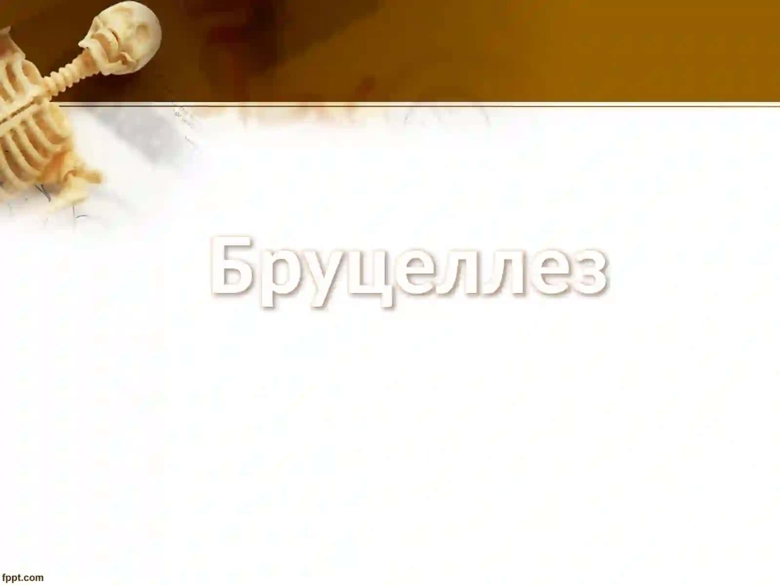 Нейробруцеллез,нейросифилисинейроспид(ВИЧ-инфекция) 2