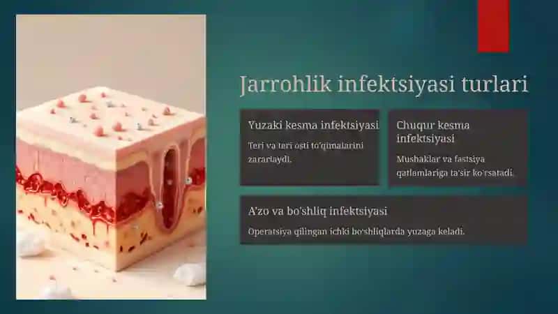 Jarrohlik infektsiyasi Umumiy ma'lumot 2