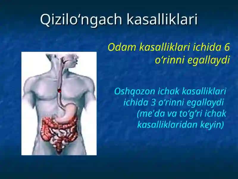 Qizilo‘ngach 2